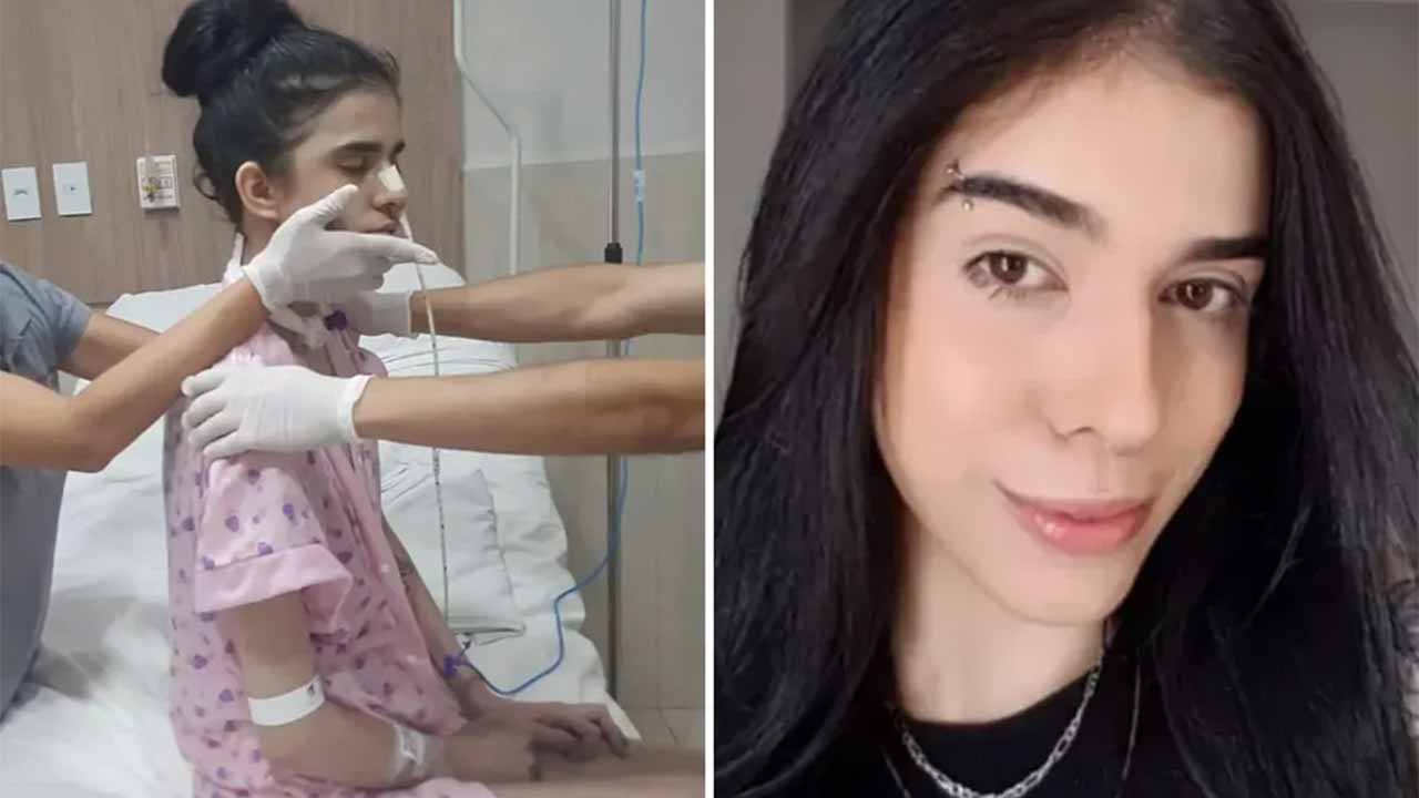 Jovem com reação alérgica a pimenta é hospitalizada em Goiânia - Descubra detalhes surpreendentes!